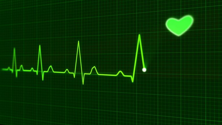 Photo of a EKG monitor graph -- HSA Health Savings Account Mason McBride